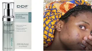 First Impression of The DDF Discoloration Reversal Moisturizer DARK SPOT CREAM REVIEW