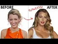 Why Blake Lively s Nose Job is Brilliant and 7 other celebrity plastic surgeries