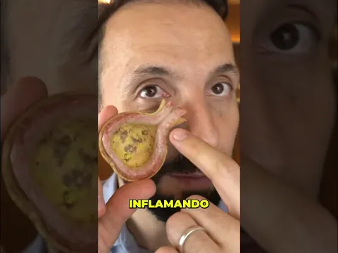Sinusite Viral: Secreção Espessa? Dr. Saada Revela o Que Fazer! #shorts