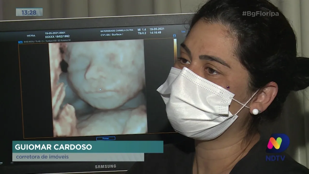 Ultrassom 3D: Maternidade Carmela Dutra é a primeira de SC a oferecer o exame pelo SUS