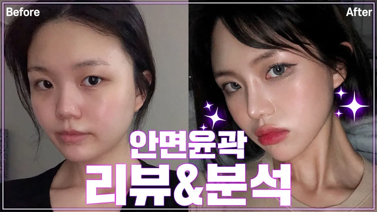 #베리굿성형외과 #박상욱원장님 사각턱 수술을 꼭 받아야 하는 얼굴형! 안면윤곽 전후사진으로 확인해보자👏👏