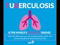 Classification of tuberculosis Using Deep Learning
