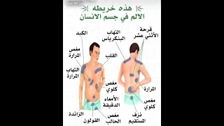 خريطة الألم في جسم الإنسان 