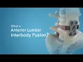 What is Anterior Lumbar Interbody Fusion? | ALIF