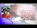More information on Paxlovid s five-day regimen of pills