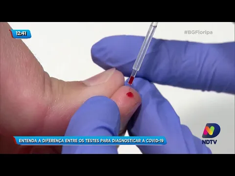 Entenda a diferença entre os testes para diagnosticar a Covid-19