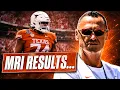 BREAKING Trevor Goosby Suffers Bone Bruise - When Will OT Return Steve Sarkisian Arch Manning