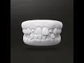 SmartForce Attachments Demo