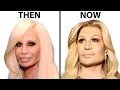 Donatella Versace s NEW FACE Plastic Surgery Analysis