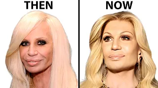 Donatella Versace's NEW FACE | Plastic Surgery Analysis