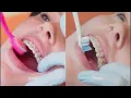 Rosenthall Orthodontics - Oral hygiene and braces care