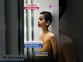 Download Lagu Ko'krak qafasi deformasiyasi bo'yicha Rossiyalik mutahassis Xorazmda 19-22 avgust! +998622277026