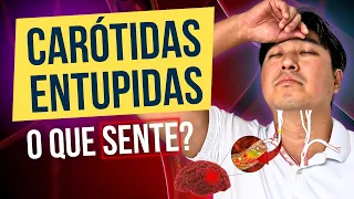 5 SINAIS DE ENTUPIMENTO DE CARÓTIDAS!