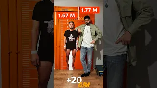 Sedat The King Of Limblengtheningsurgery Gained Worldwide Fame With A Record Extension Of 20 Cm  Sedat The King Of Limblengtheningsurgery Gained Worldwide Fame With A Record Extension Of 20 Cm