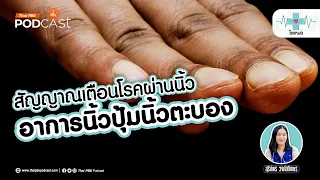 อาการของนิ้วปุ้มมีลักษณะอย่างไรบ้าง