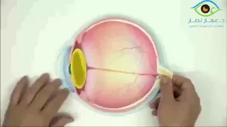 كل ما تريد معرفته عن المياة البيضاء عملية المياه البيضاء دكتور عمار نصار 