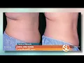 Natural Results by North Valley offers life changing new Trusculpt