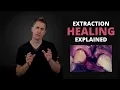 What Does Normal Healing Look Like After A Tooth Extraction OnlineExodontia com