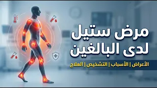   مرض ستيل لدى البالغين   نظرة عامة   الأعراض   الأسباب   التشخيص   العلاج دندنها