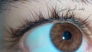 نتائج إحدى صديقاتي بي سبليمنال العيون 