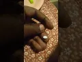 Generic 1mg gg258 football shape alprazolam description 18yrs