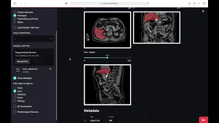 AI Automatic Organ Segmentation and 3D visualisation Web App