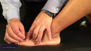 Liuwan T 66 08 Shuiqu T 66 09 Master Tung Needling Technique By Chuan Min Wang 