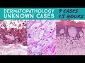 Dermatopathology Unknown Cases for University of New Mexico UNM Dermatology Residents Board Review