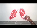 Systemic Enzyme Therapy and Pulmonary Fibrosis - Presented by Pulmonary Fibrosis NOW