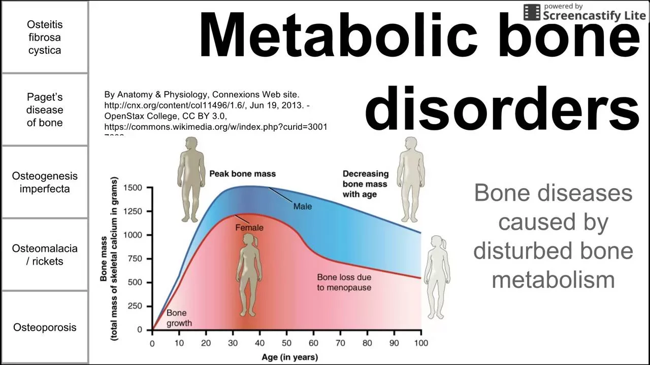 Metabolic Bone Disorders