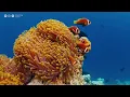 Relaxing Music Healing Stress, Anxiety and Depressive States, Heal Mind, Body and Soul Calming Music