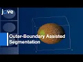 Outer-Boundary Assisted Segmentation Trabecular Bones-Imagej Plugin l Protocol