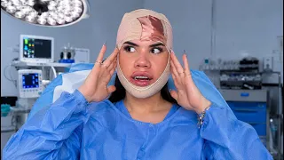 ¿QUE LE PASO A MI CARA?¿ME OPERE?