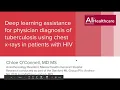 Deep learning assistance for physician diagnosis of TB using chest x-rays in patients with HIV