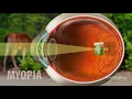 Myopia Nearsightedness explained