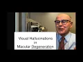Download Lagu Visual Hallucinations and Macular Degeneration