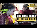 Lagu Ternyata Ditangan Niken Salindry Ada Luka Bakar, Kok Bisa Ya ???
