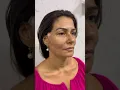 Download Lagu Dr Gustavo Faissal Haidar, harmonização facial com muita naturalidade!