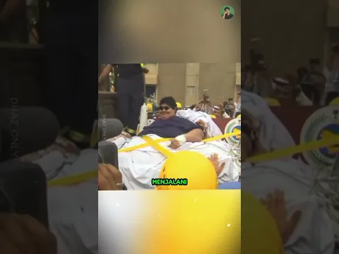 Pria Ini Pernah Punya Berat Setengah Ton..