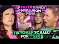 Exposing The Lip Filler Bandit Hyaluron Pen Disaster TikToker Scams For 20 140