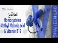 Lagu ما العلاقة بين تحاليل Homocysteine و MMA و Vitamin B12 وتفسير النتائج ؟