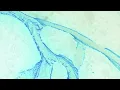 Blondie - Heart Of Glass (Johnson Somerset remix)