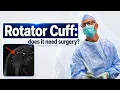 Rotator Cuff Tear When Surgery is Your Best option