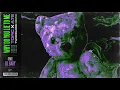 Topic, A7S - Why Do You Lie To Me (twocolors Remix / Visualizer) ft. Lil Baby