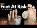 Download Lagu Feet At Risk: The Return