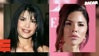 EXCLUSIVE Lauren Sanchez s Dramatic Before and After Plastic Surgery Revealed - With Top Surgeo