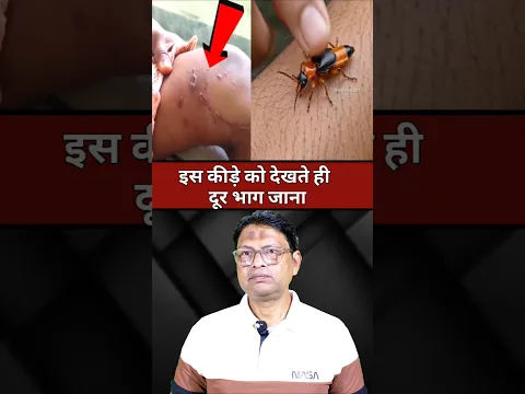 🚨 गलती से भी मत मारना इस कीड़े को #shorts #facts #viralvideo #education #knowledge