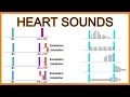 Download Lagu Heart Sounds (Murmurs and Splitting)