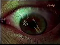 Download Lagu Iklan Sampoerna Hijau Voli Proliga - Dilarang Berkedip! (2004)