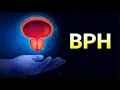 Benign Prostatic Hyperplasia Enlarged Prostate - CRASH Medical Review Series